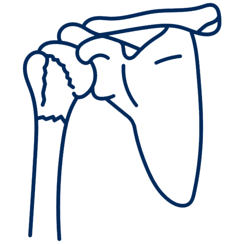 shoulder-fracture icon
